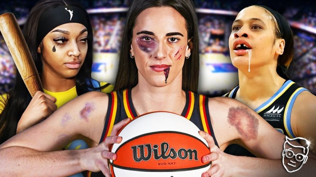 The WNBA Is Trying To Kill Caitlin Clark